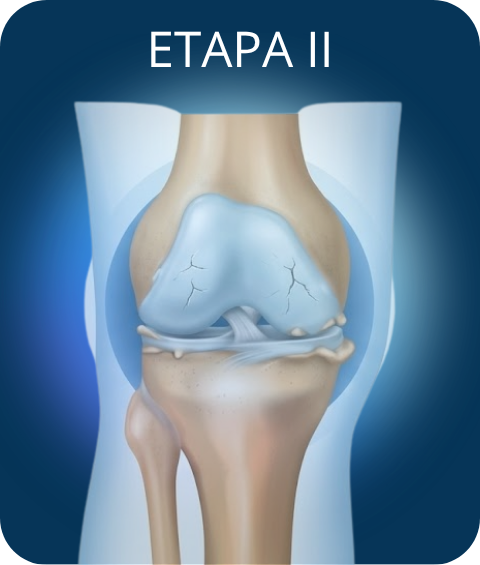 Cartilago etapa 2